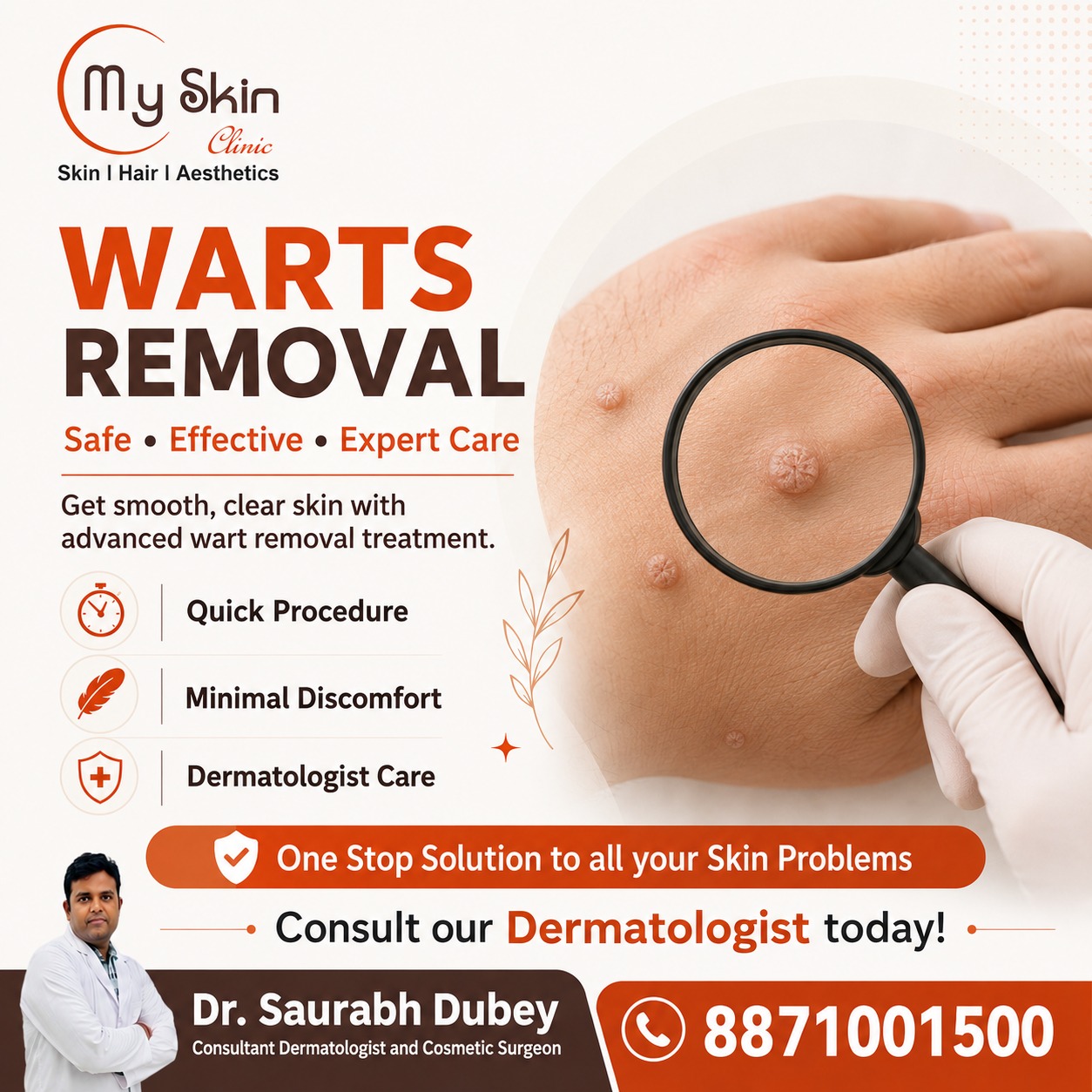Warts Removal Treatment in Indore